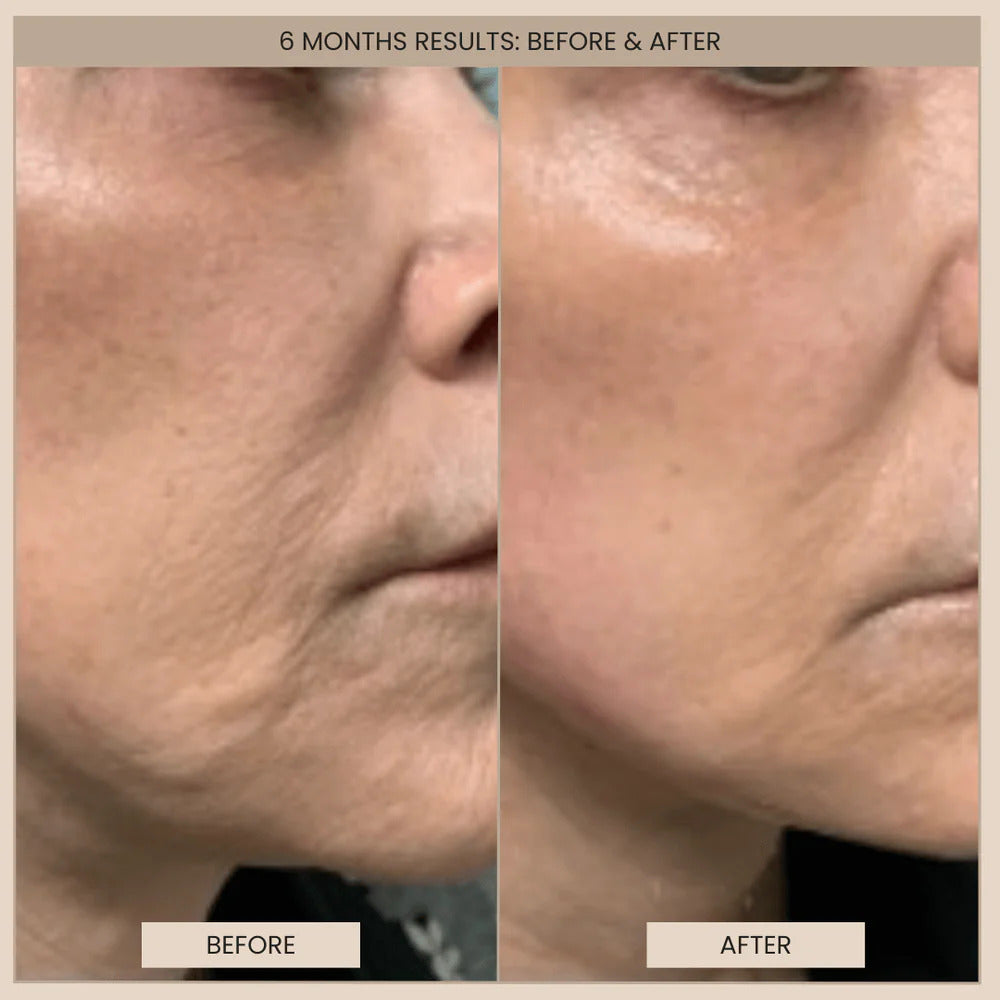 evenskyn Before and after comparison of facial skin texture on a person's cheek.
