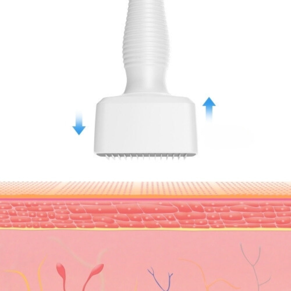 Illustration showing how the 140 fine needles penetrate the skin to stimulate collagen production