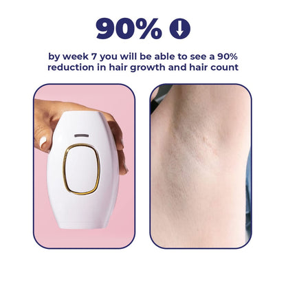 Urban Skinn Portable IPL Hair Remover