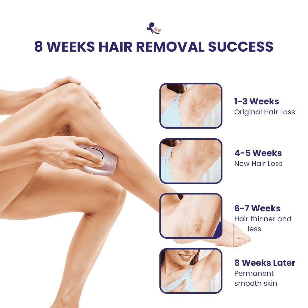 MomDaughts' IPL Hair Remover New.