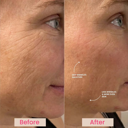 Urbanskinn® Lumo⁺: Premium Anti-Aging & Skin Tightening Handset