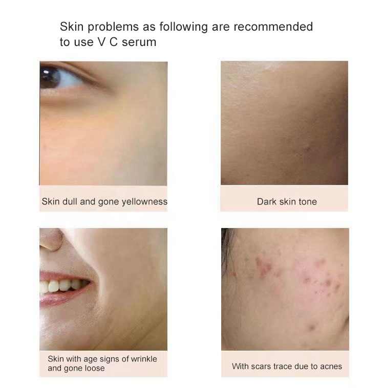 15% vitamin C anti-aging serum