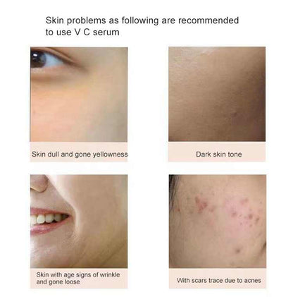 15% vitamin C anti-aging serum